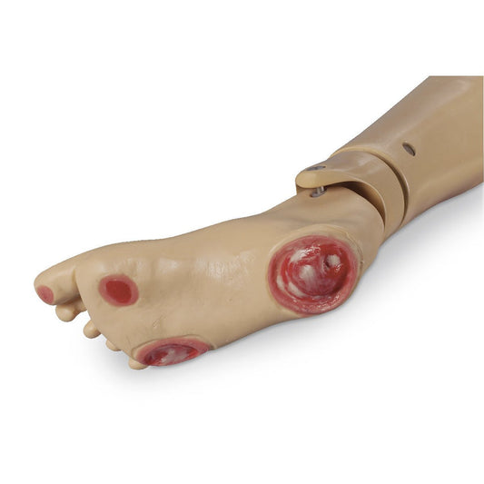 Life/Form GERi/KERi Optional Pressure Ulcer Foot
