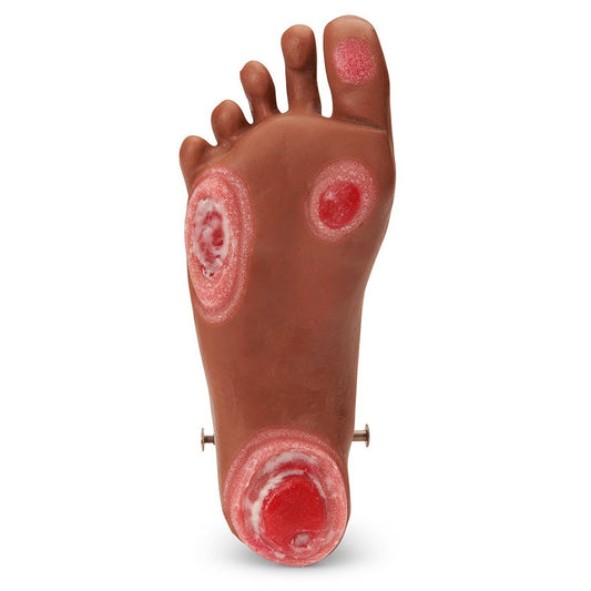 Life/Form® GERi™ / KERi™ Optional Pressure Injury Foot - Medium